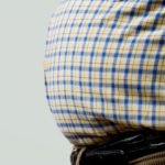 Being overweight linked to psoriatic arthritis