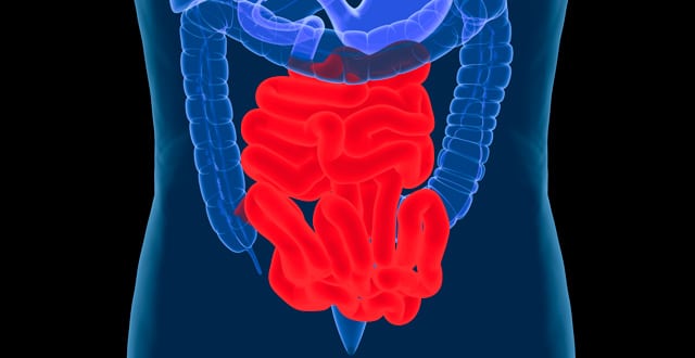 Ct Colonography Imaging Technology That Has Come Of Age Medical Independent