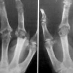 Single-specialty rheumatology ‘required to reduce waiting lists’