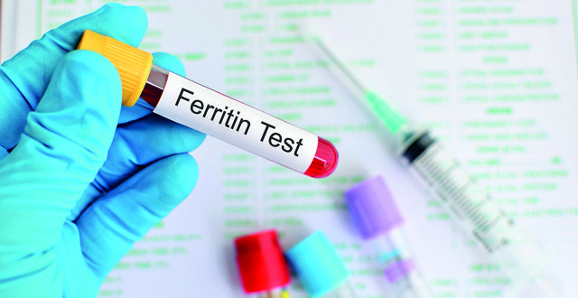 Test tube with blood sample for ferritin test