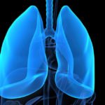 Scleroderma patients potential candidates for lung transplantation