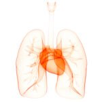 Diffuse cystic lung diseases underdiagnosed