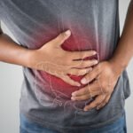 Immune-related colitis – an issue in cancer patients