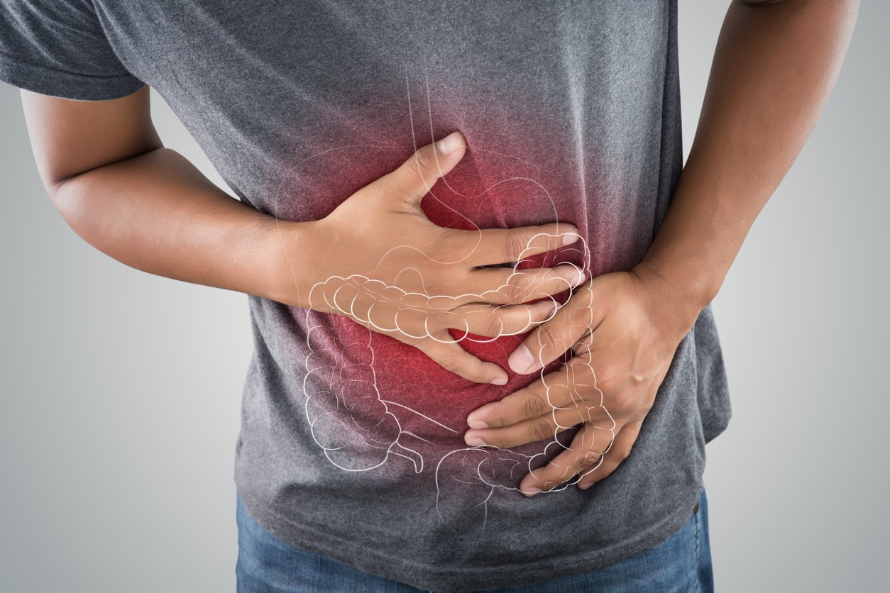 Immune-related colitis – an issue in cancer patients