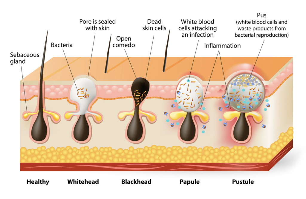 dermatology in Ireland