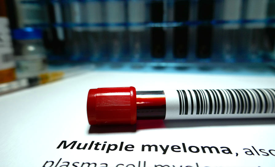 myeloma