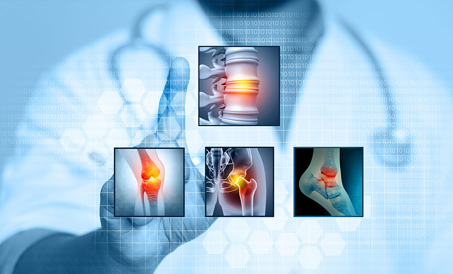 rheumatic disease