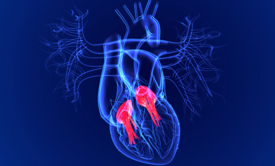 Heart valve disease