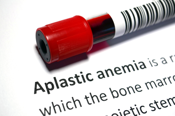 aplastic anemia