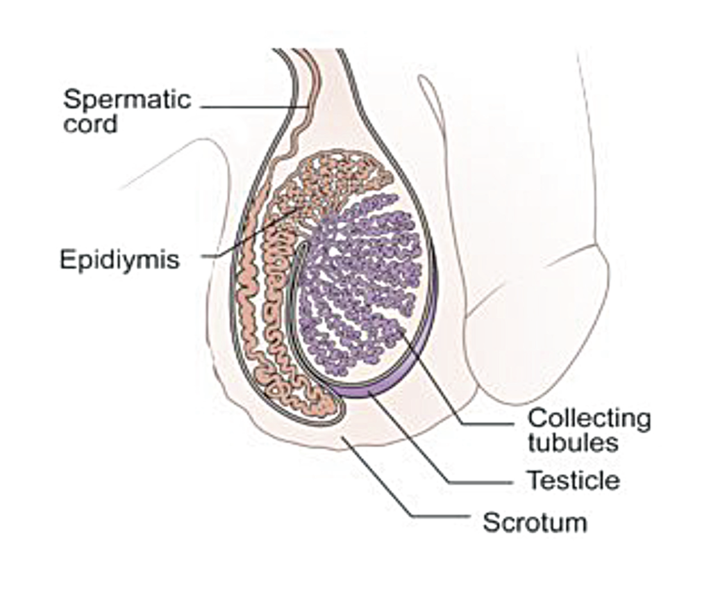 Testicular cancer