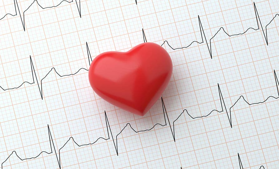 cardiac monitoring