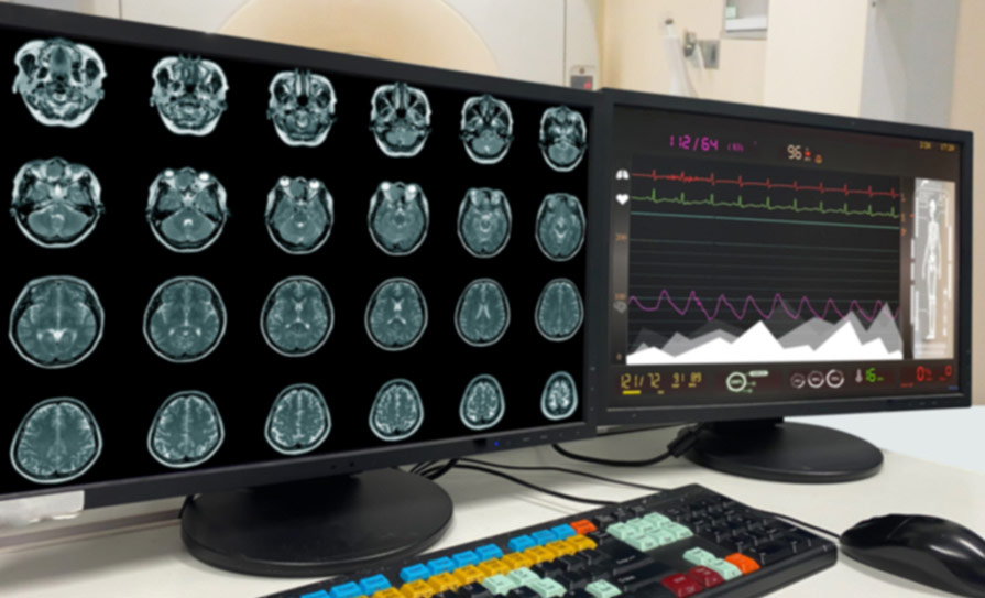 aneurysm screening