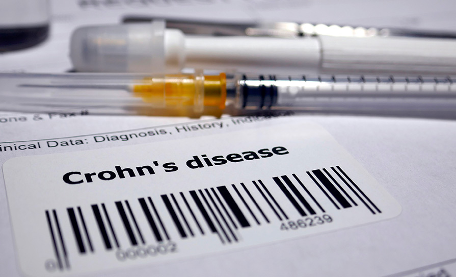 crohn's disease