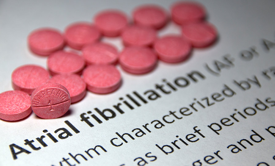 Atrial fibrillation