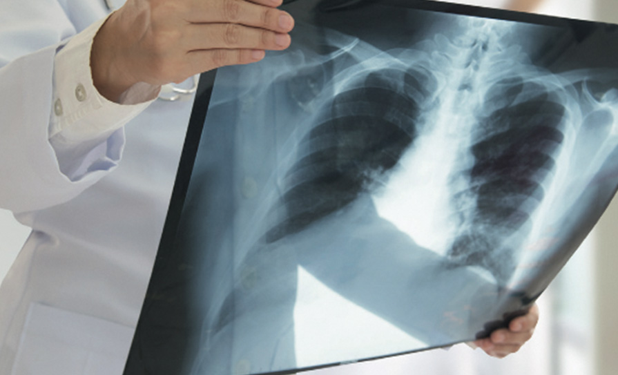 respiratory posts