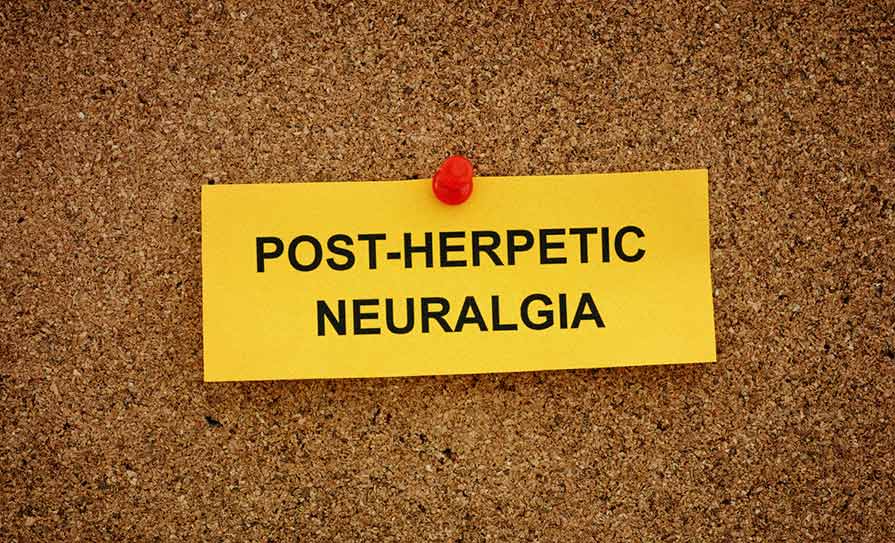 Post-herpetic neuralgia