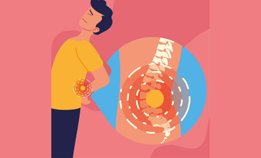 Axial spondyloarthritis