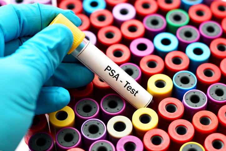 prostate cancer screening test