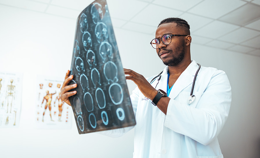 Migraine and MS
