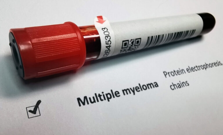 New EHA/EMN guidelines on the management of multiple myeloma - Medical ...