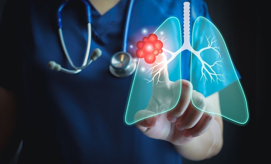 interstitial lung disease