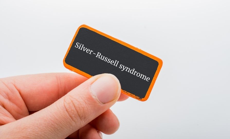 Silver-Russell