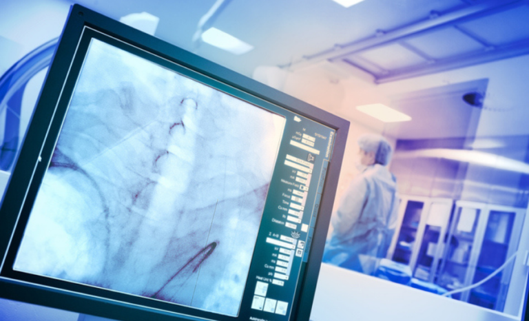 First national Model of Care for Interventional Radiology launched ...