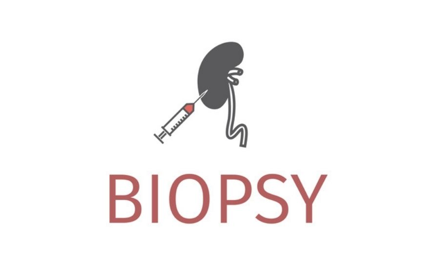 biopsy