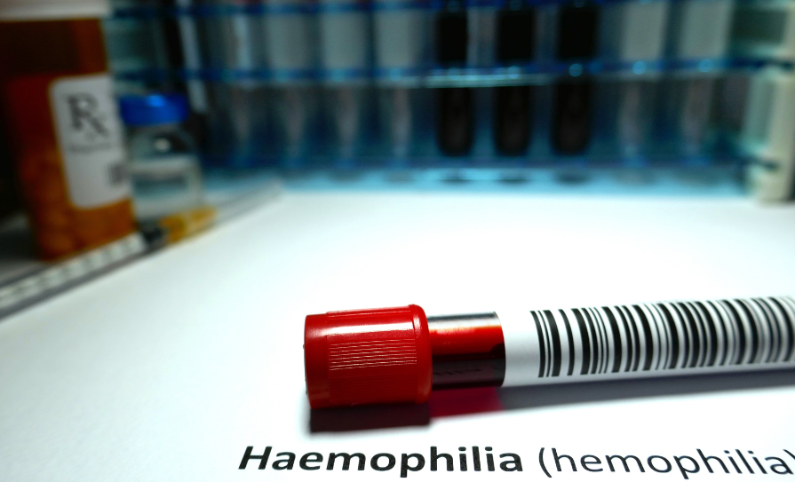 Haemophilia