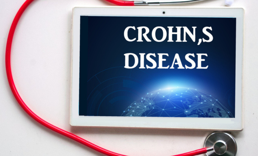 Crohn’s