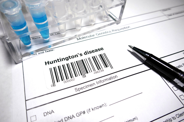 Hungingtons disease
