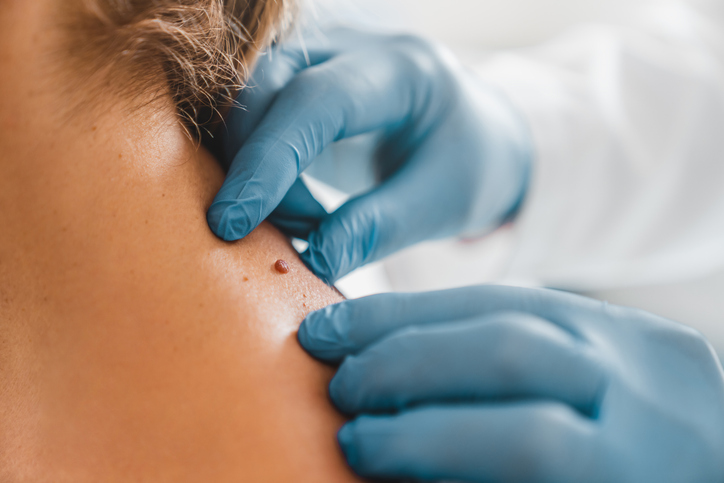 dermatology services