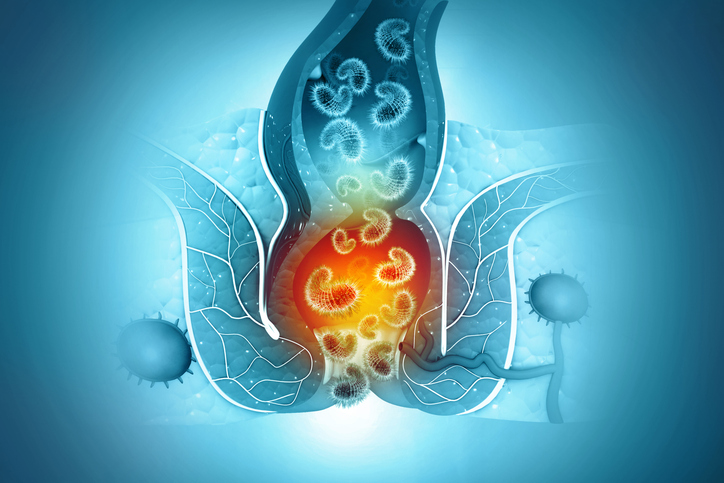 Anogenital Pruritus